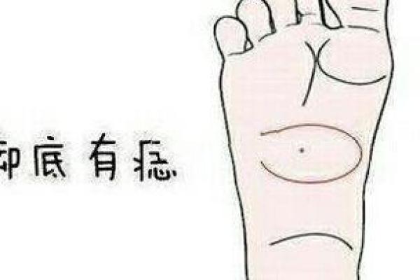 印堂痣和观音痣的区别 观音痣是富贵好命的代表